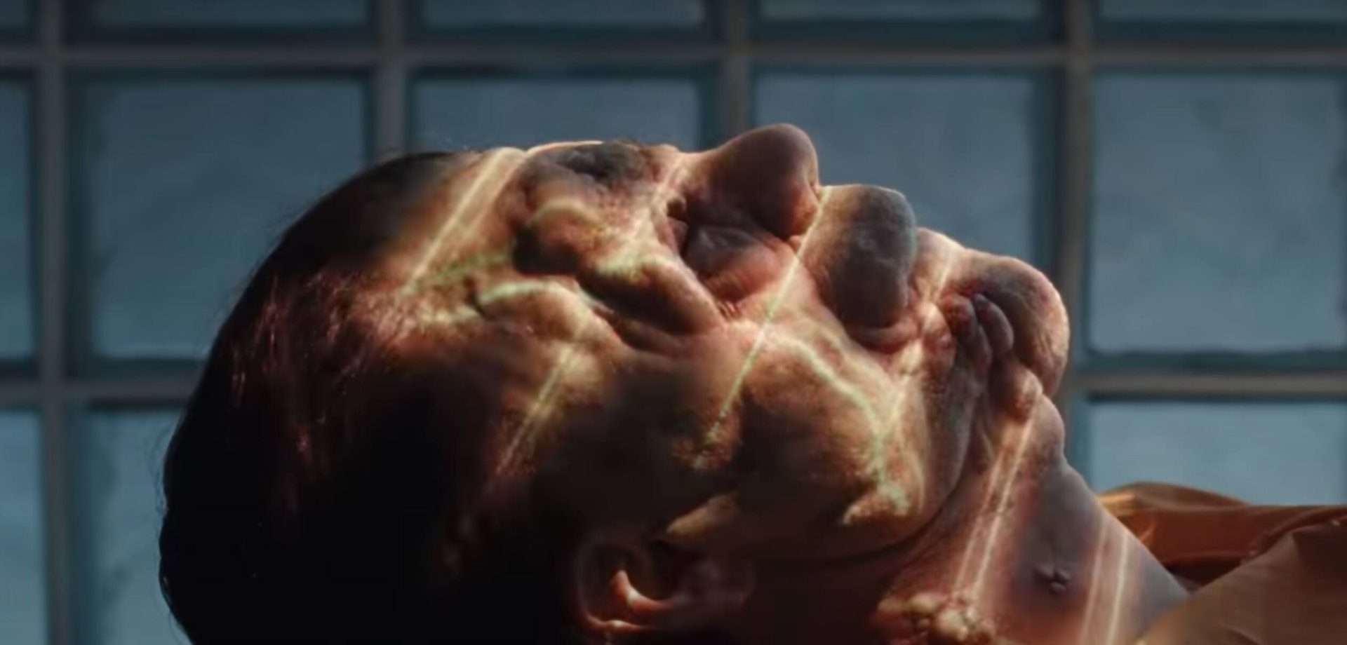 A Different Man (2024) Movie Ending Explained & Themes Analysed